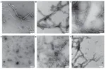 Imágenes por microscopía electrónica de distintas preparaciones de fibrillas de alfa-sinucleína. La alfa-sinucleína es una de las proteínas clave en la patología de Parkinson cuando forma agregados.