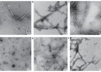 Imágenes por microscopía electrónica de distintas preparaciones de fibrillas de alfa-sinucleína. La alfa-sinucleína es una de las proteínas clave en la patología de Parkinson cuando forma agregados.