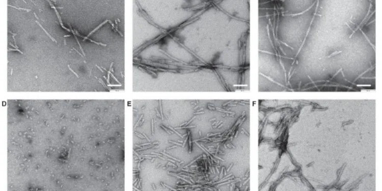 Imágenes por microscopía electrónica de distintas preparaciones de fibrillas de alfa-sinucleína. La alfa-sinucleína es una de las proteínas clave en la patología de Parkinson cuando forma agregados.
