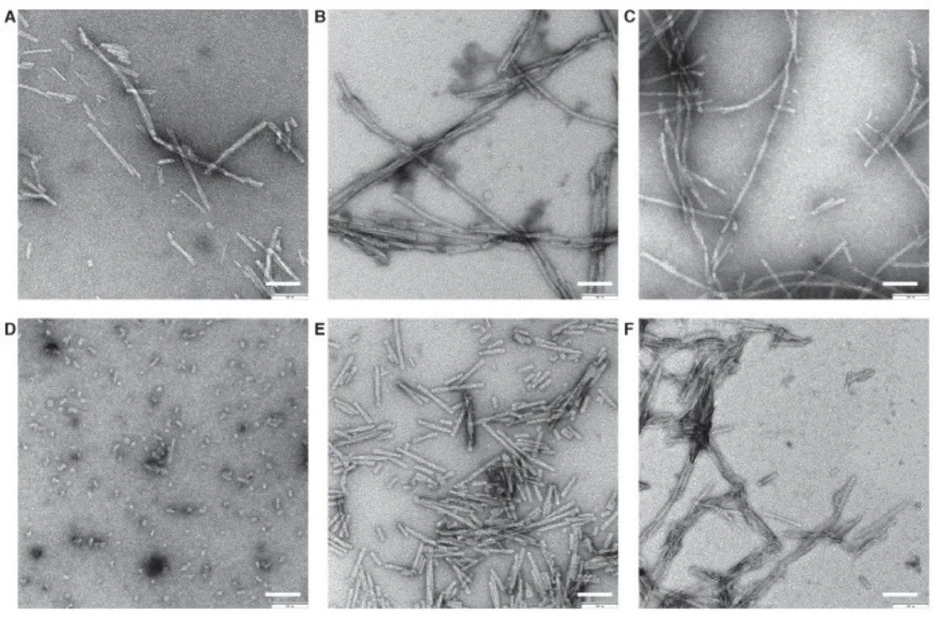 Imágenes por microscopía electrónica de distintas preparaciones de fibrillas de alfa-sinucleína. La alfa-sinucleína es una de las proteínas clave en la patología de Parkinson cuando forma agregados.