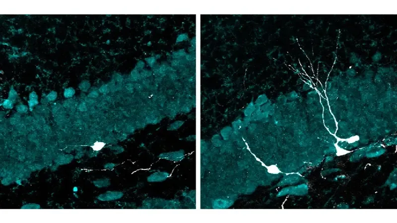 A la izquierda, en blanco, se ve una neurona con dendritas muy incipientes en un cerebro envejecido. A la derecha, tras la estimulación multisensorial de 40 Hz, se observa el aumento en la cantidad de neuronas y una mayor complejidad dendrítica. fin Alzheimer