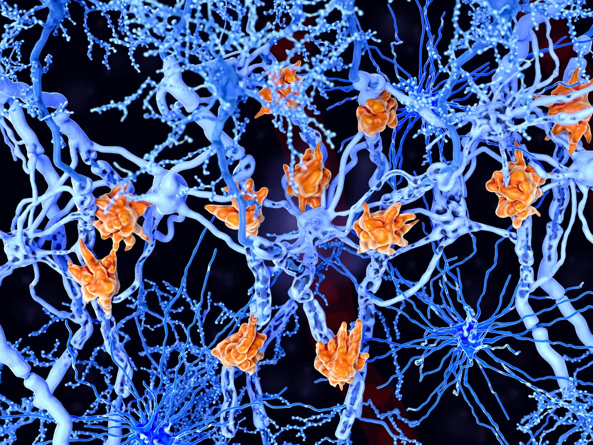 Imagen representativa de las células de la microglía (en naranja) que se encuentran rodeando los axones neuronales (en azul). fin del Alzheimer